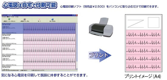 心電図印刷ソフト HCG-SOFT-2　心電図は自宅で印刷可能